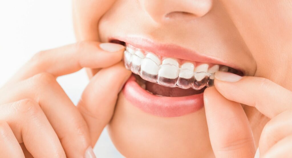 Dental night guards in Thousand Oaks