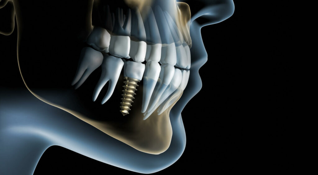 Oral and maxillofacial surgery in Thousand Oaks