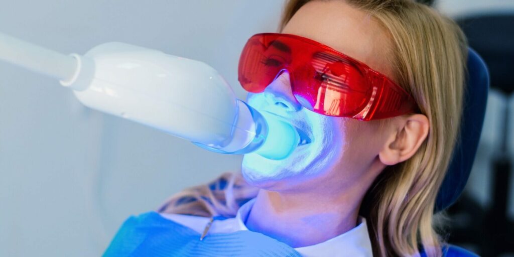 Close-up of a patient undergoing a modern teeth whitening procedure in a dental clinic.