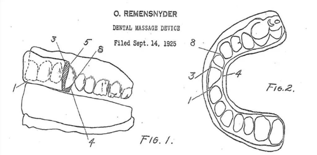 1925 Remensnyder Dental Massage Device, an early orthodontic tool designed to massage gums and inadvertently influence tooth alignment, marking a foundational development in clear aligner technology.