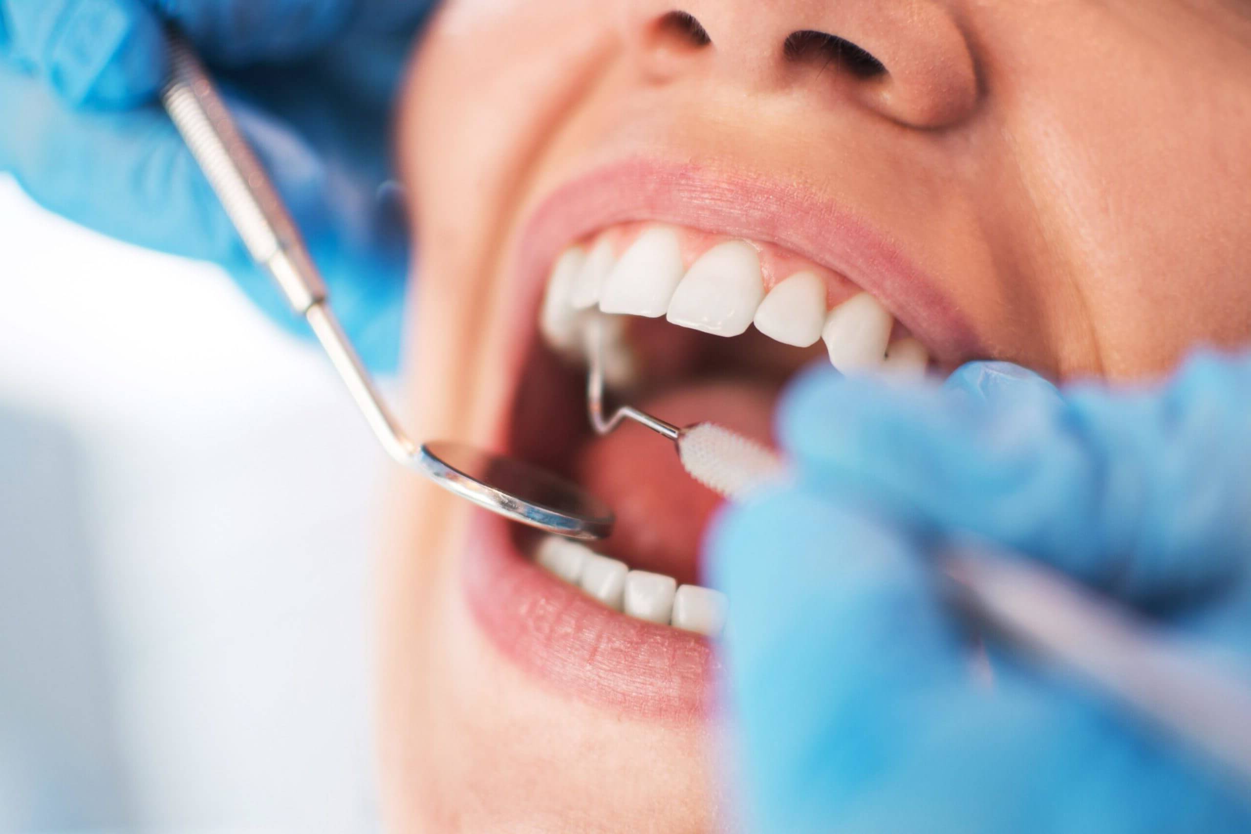 Dental cleaning in Thousand Oaks, Ventura