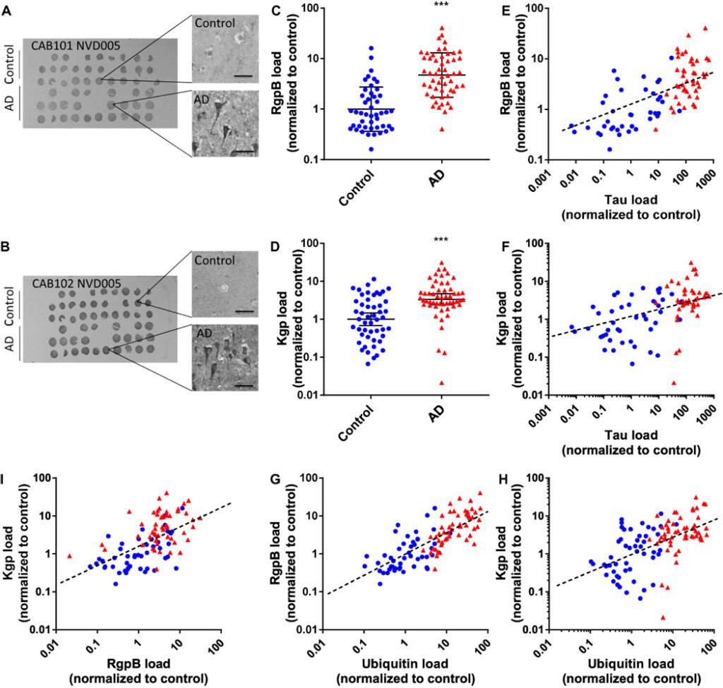 Fig. 1 Gingipain IR in brain correlates with AD diagnosis and pathology