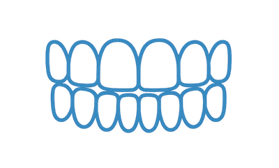 General Alignment Invisalign