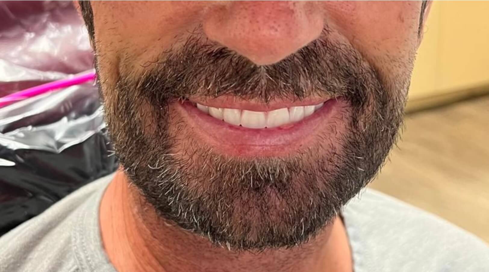 After Dentures in Thousand Oaks